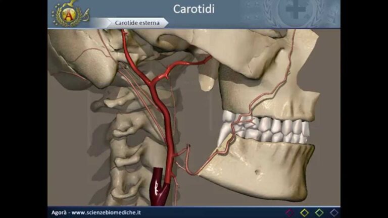 Importanza delle Carotidi Interne nella Salute Cerebrale