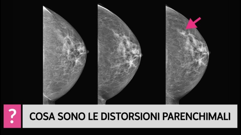 Comprendere il Parenchima Mammario: Funzioni e Importanza