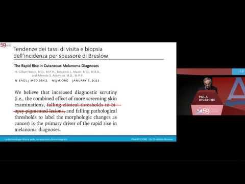 Spessore di Breslow: Importanza e Implicazioni nella Diagnosi del Melanoma