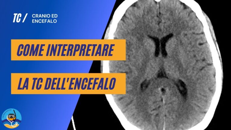 Comprendere il Parenchima Cerebrale: Funzioni e Importanza