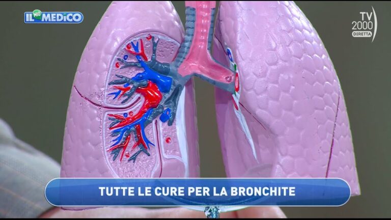 Focolaio Bronchiale: Cause, Sintomi e Rimedi Efficaci