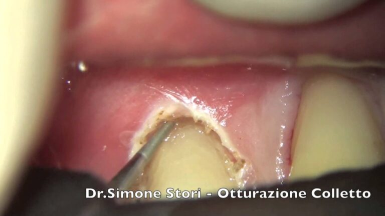 Colletti Dentista: Guida alla Salute Orale Ottimale