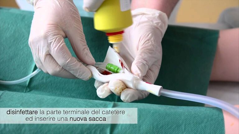 Complicazioni Post-Operatorie del Catetere